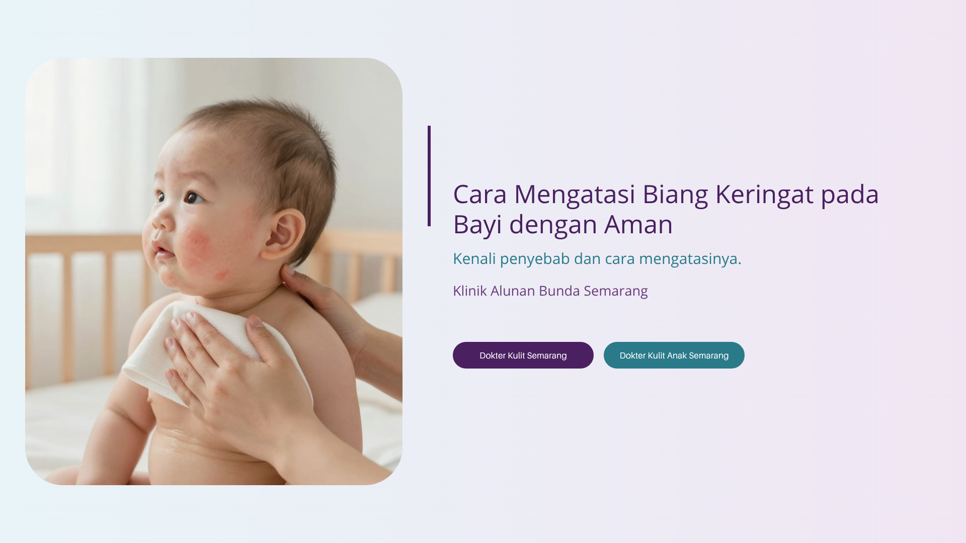 Cara Mengatasi Biang Keringat pada Bayi dengan Aman