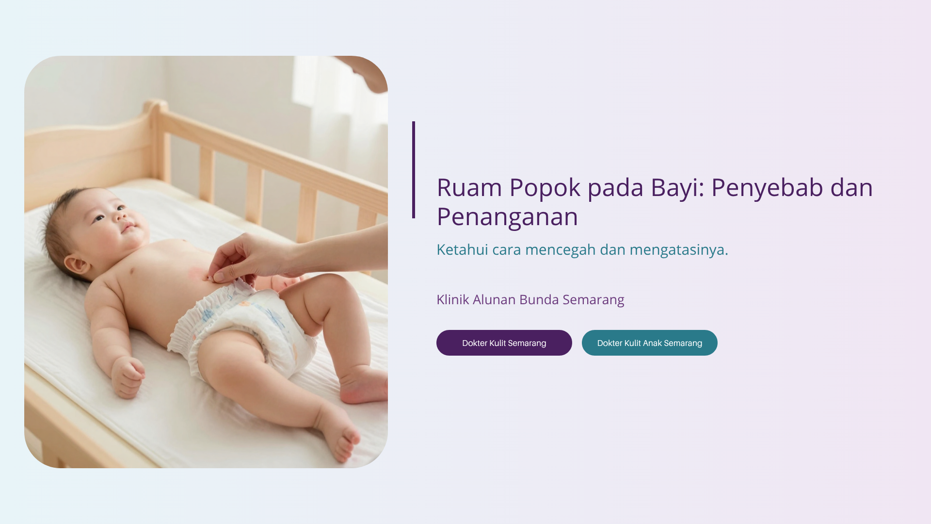Ruam Popok pada Bayi: Penyebab dan Penanganan