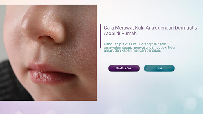 Cara Merawat Kulit Anak dengan Dermatitis Atopi di Rumah