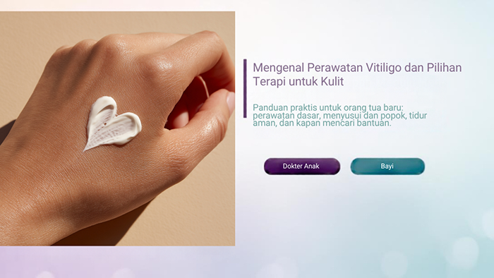 Mengenal Perawatan Vitiligo dan Pilihan Terapi untuk Kulit