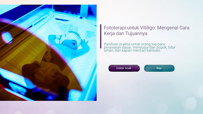 Fototerapi untuk Vitiligo: Mengenal Cara Kerja dan Tujuannya